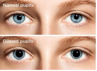 normal and dilated eyes